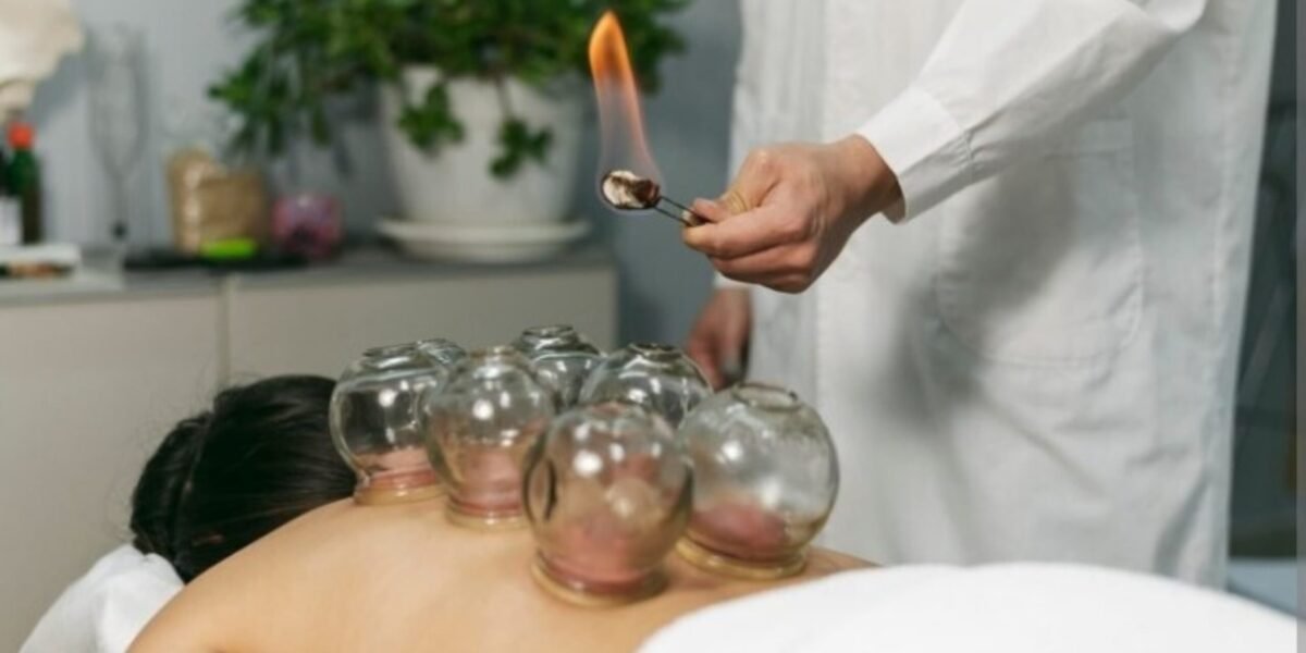 Fire cupping therapy Fire cupping therapy