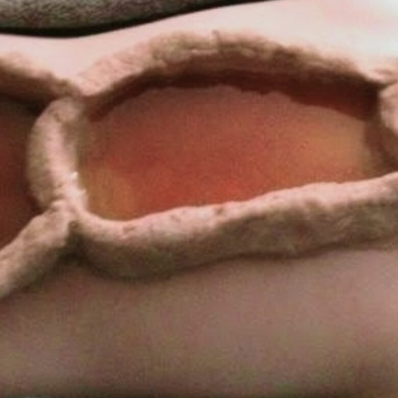 Talapotichill Therapy